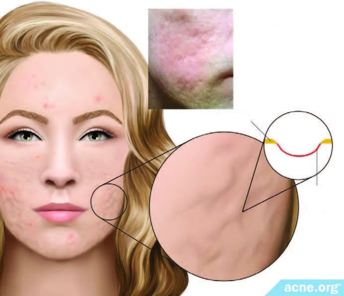 SP_INTL_TreatmentTrainerTools_Full-binder_A4_APPROVED-1_Page_1_Image_0003 no text